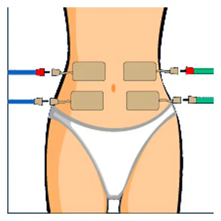 Compex electrodes wire 5x10 cm, 2 pieces